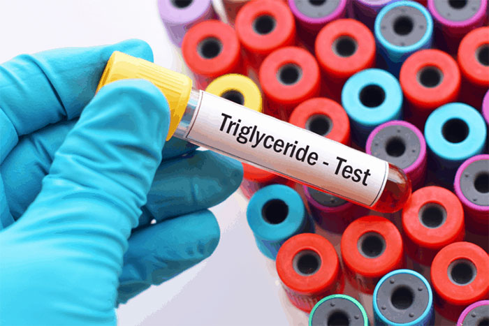 Chỉ số Triglyceride là gì?
