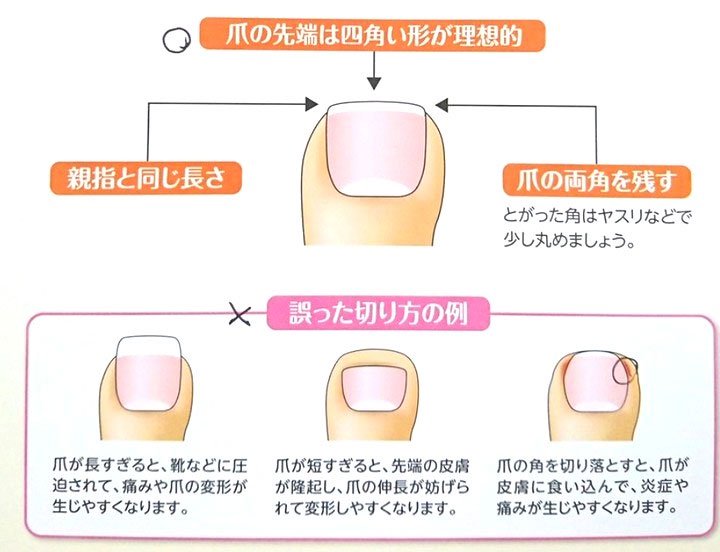 Chuyên gia Nhật khẳng định mọi người đều cắt móng chân sai cách, đây mới là cách làm đúng!