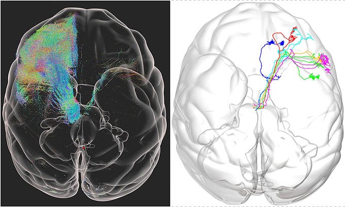 Công bố ảnh 3D độ phân giải cao đầu tiên của não khỉ
