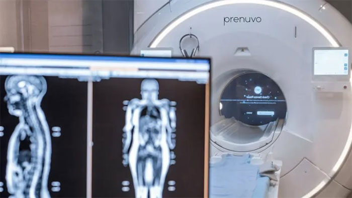 Công nghệ y khoa tiên tiến: Chỉ 2.500 USD có thể phát hiện ung thư lẫn 500 bệnh khác sau khi quét toàn thân