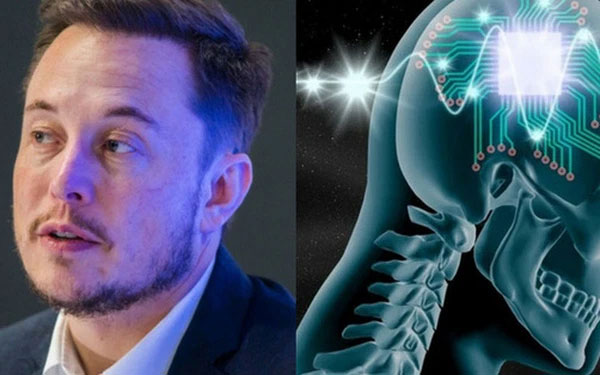 Công ty của Elon Musk chuẩn bị cấy ghép chip vào não người để chế tạo siêu nhân