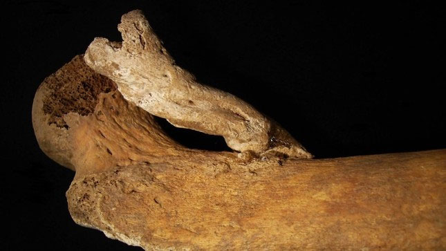 Giải mã bộ xương đùi bí ẩn của một phụ nữ từ thế kỷ 14-19