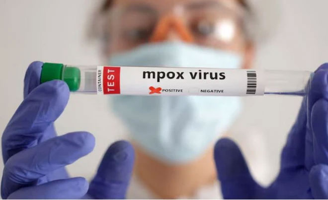 Giới nghiên cứu cho hay: Virus gây bệnh đậu mùa khỉ biến đổi nhanh hơn bình thường