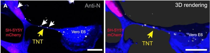 Hé lộ con đường virus SARS-CoV-2 xâm nhập vào các tế bào thần kinh