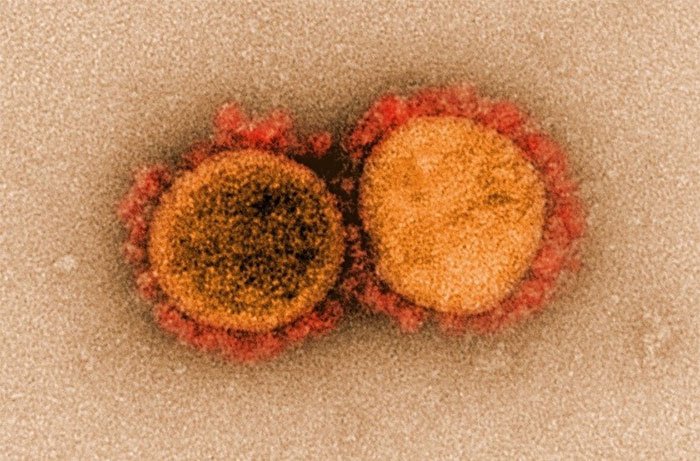 Kịch bản ác mộng từ biến chủng virus mới phát hiện ở California