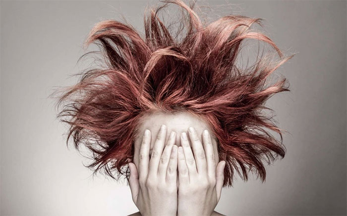 Kỳ lạ hội chứng tóc không thể kết hợp, tự biến mất khi trưởng thành