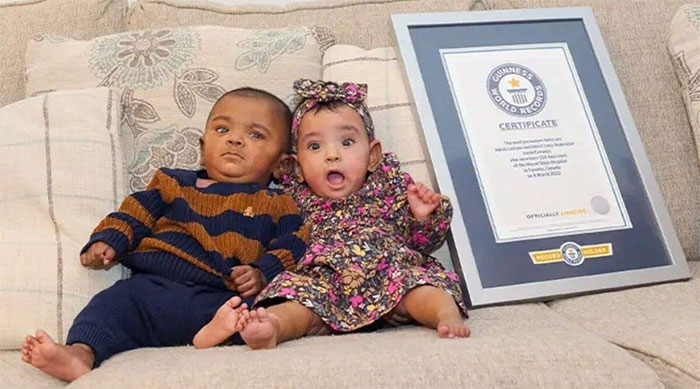 Kỷ lục Guinness cho cặp song sinh đẻ non nhất thế giới