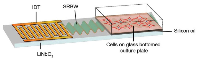 Liệu pháp tế bào gốc kết hợp sóng âm có thể giúp xương gãy mọc trở lại