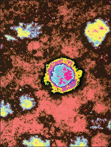 Loại virus hiếm gây tử vong gần 100% bất ngờ tái xuất