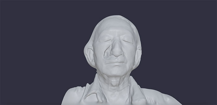 Mũi in 3D dành cho các bệnh nhân ung thư ở Singapore