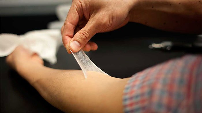 Nga chế tạo vải da nhân tạo để băng vết thương