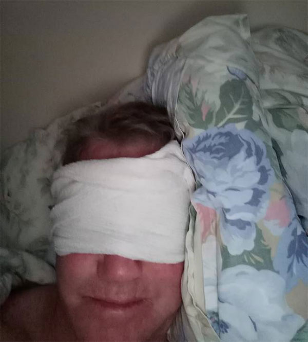 Người đàn ông không nhắm mắt suốt 3 năm, khi ngủ phải băng kín mắt