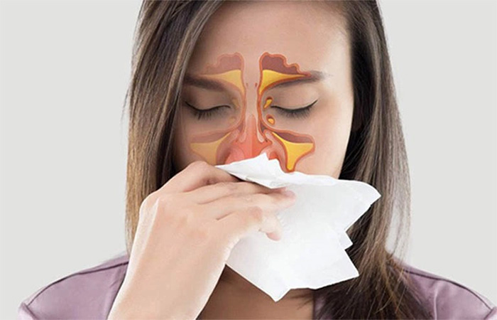 Người viêm mũi dị ứng có 2 món không ăn - 3 món ăn nhiều để không khiến bệnh thêm trầm trọng