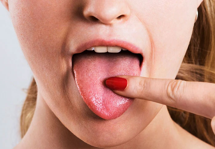Nguyên nhân gây ra vị chua trong miệng là gì?