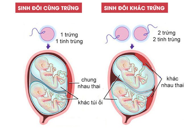 Những đứa trẻ sinh đôi: Bí ẩn tiến hóa hay chỉ là một tai nạn tình cờ?