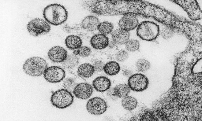 Những loại virus nguy hiểm trên Trái Đất