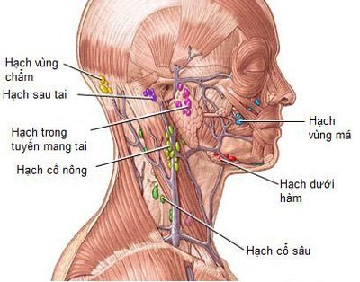 Nổi hạch ở cổ bên trái cảnh báo mắc bệnh gì?