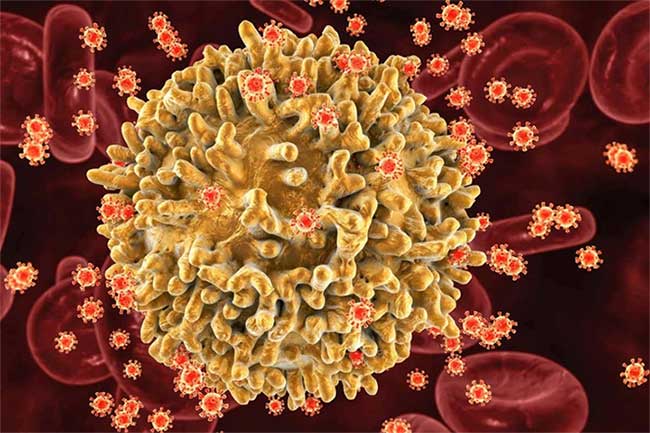Phát hiện biến thể mới siêu lây nhiễm của HIV, dễ thành AIDS hơn