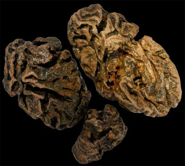 Phát hiện não 12.000 năm tuổi, có cơ chế bí mật mà khoa học chưa biết?