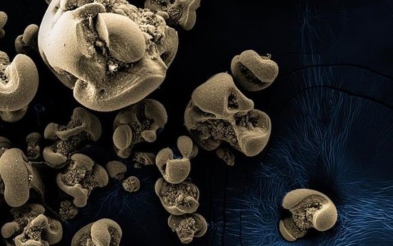 Phát hiện vi khuẩn ăn kim loại sau một thế kỷ tìm kiếm