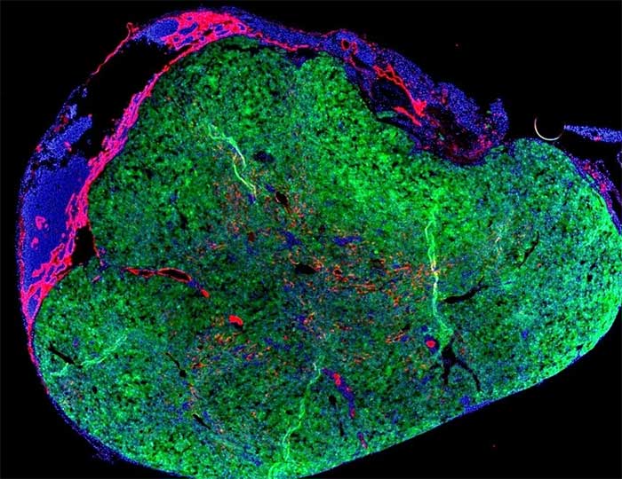 Phát triển lá gan mới trong cơ thể người từ túi tế bào
