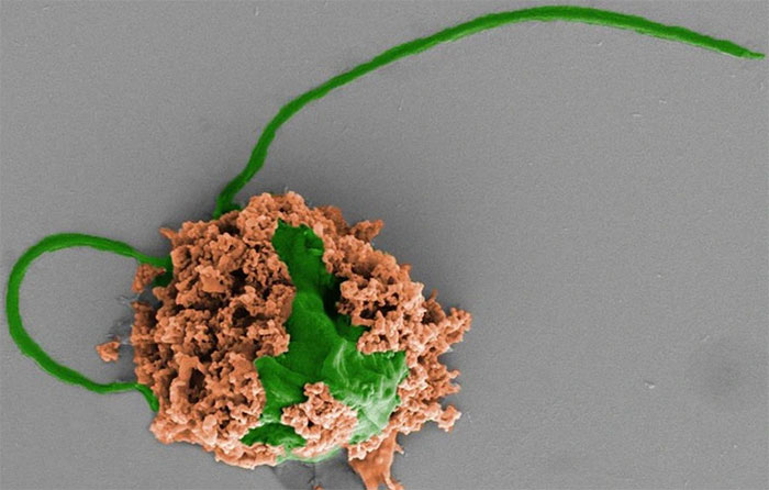 Robot tảo siêu nhỏ đưa thuốc trực tiếp tới phổi diệt ung thư