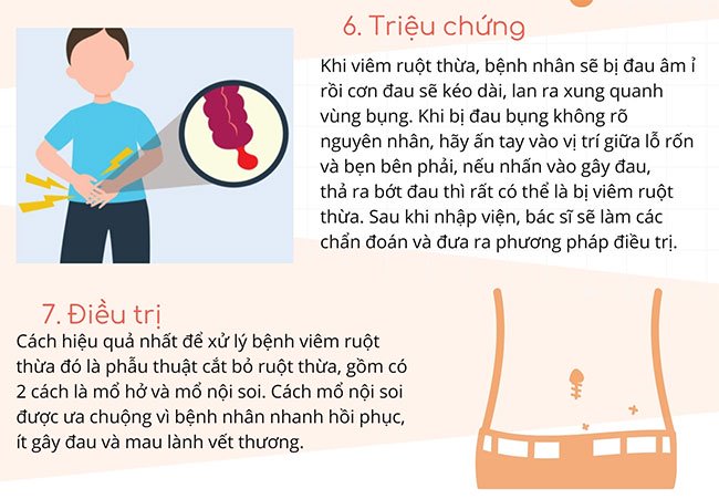 Ruột thừa có lợi hay hại? Triệu chứng và cách xử lý khi bị viêm ruột thừa