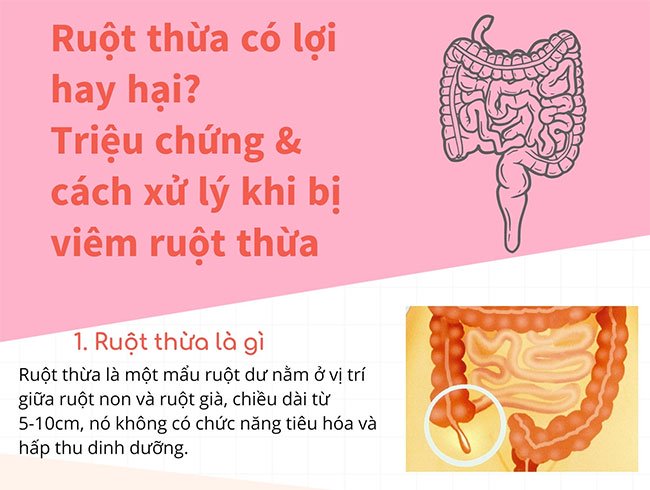 Ruột thừa có lợi hay hại? Triệu chứng và cách xử lý khi bị viêm ruột thừa