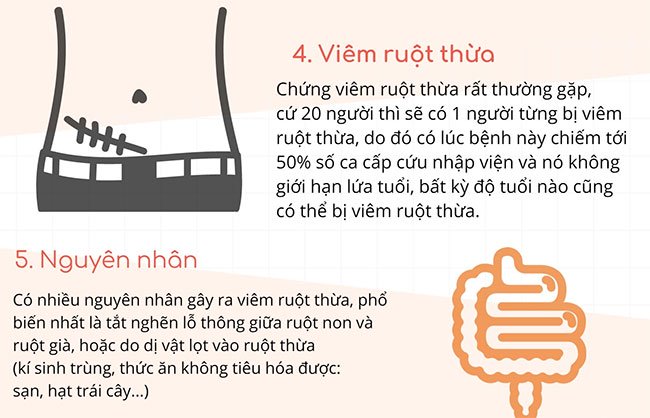 Ruột thừa có lợi hay hại? Triệu chứng và cách xử lý khi bị viêm ruột thừa