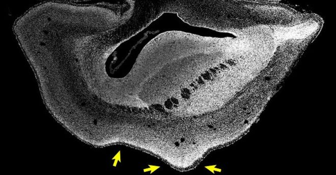 Sử dụng gene người, các nhà nghiên cứu tăng thành công kích cỡ và nếp nhăn của não khỉ