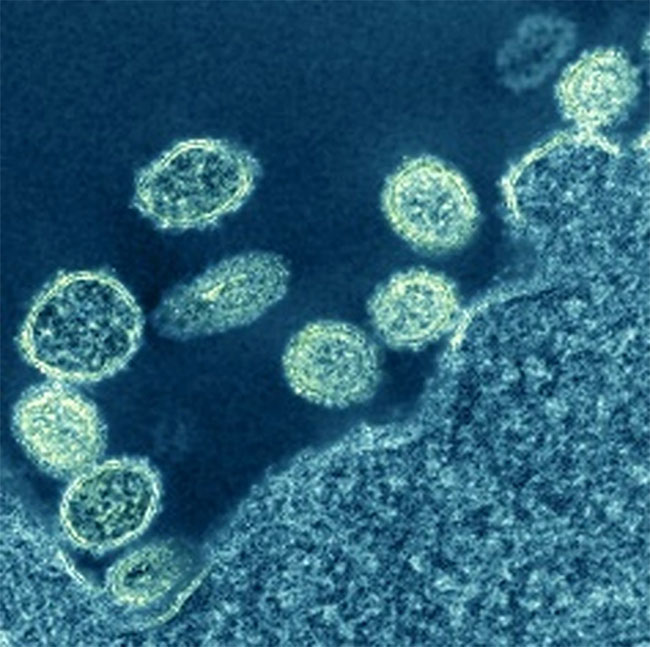 Tai nạn phát tán virus có thể đã gây ra đại dịch bí ẩn năm 1977