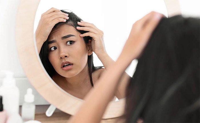 Tại sao căng thẳng lại gây rụng tóc?