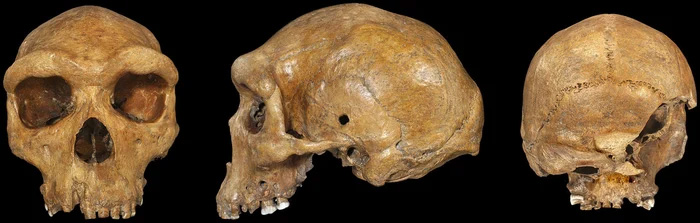 Tại sao lại có lỗ đạn xuất hiện trên các hộp sọ tiền sử?