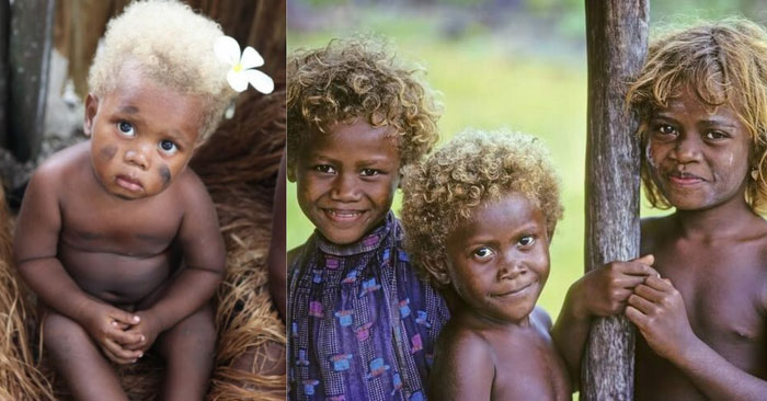 Tại sao lại có những người da đen sở hữu mái tóc vàng tự nhiên?
