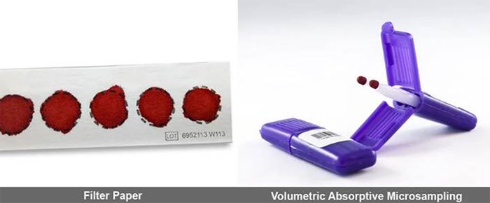 Tại sao máu khô lại được chọn để tách chiết ADN?