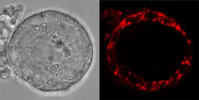 Tế bào trứng của con người có thể tồn tại đến 50 năm