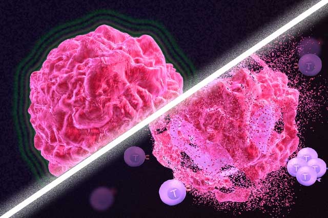 Tế bào ung thư tồn tại và phát triển trong cơ thể chúng ta như thế nào?