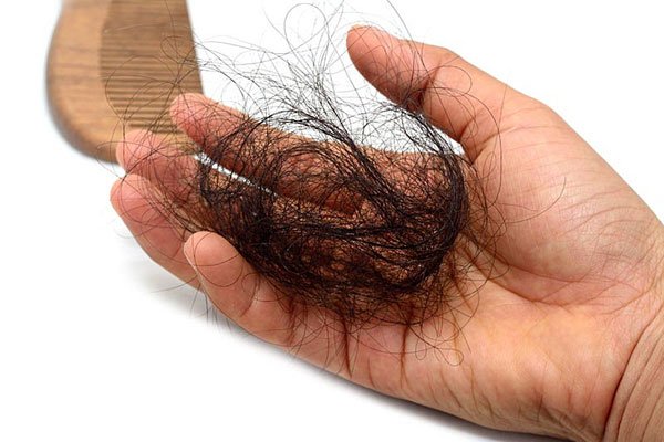 Tìm ra phương pháp mới để chống rụng tóc