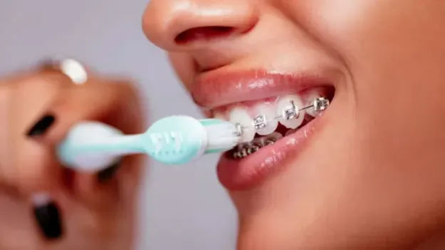 Top 9 sự thật thú vị về răng có thể khiến bạn bất ngờ