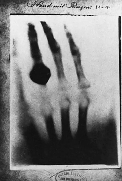 Vén màn sự thật đau đớn đằng sau thí nghiệm tạo ra tia X-quang đầu tiên trên thế giới