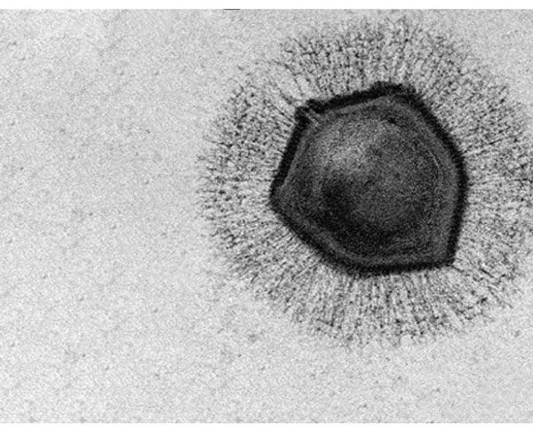 Virus đến từ đâu và chúng có phải là sinh vật sống hay không?