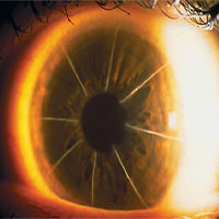 Bệnh nhân với con mắt như bánh pizza 8 miếng là minh chứng cho thấy y học từng rất đáng sợ