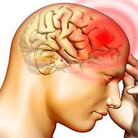 Bệnh phù não: Nguyên nhân, triệu chứng và cách điều trị