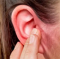 Bệnh viêm tai ngoài là gì?