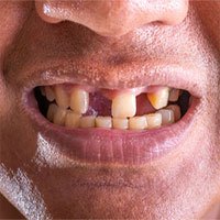 Các nhà khoa học tìm ra cách có thể giúp con người mọc lại răng