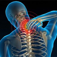 Cách đơn giản phòng trị đau cổ gáy, đau lưng