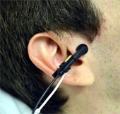 Cải thiện sức khỏe tim mạch nhờ kích điện lỗ tai