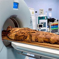 Giải mã xác ướp Ai Cập bằng công nghệ CT scan