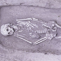 Hài cốt 5.000 năm tuổi mắc hội chứng lùn hiếm gặp