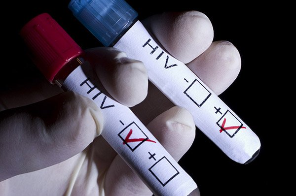 HIV sẽ được loại bỏ vào năm 2030?